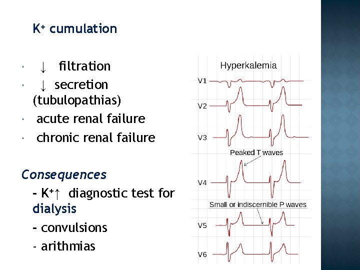 K+ cumulation ↓ filtration ↓ secretion (tubulopathias) acute renal failure chronic renal failure Consequences