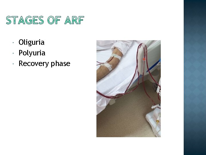  Oliguria Polyuria Recovery phase 