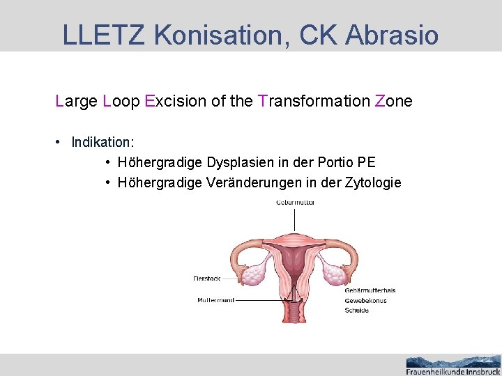 LLETZ Konisation, CK Abrasio Large Loop Excision of the Transformation Zone • Indikation: •