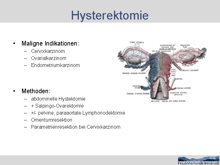 Hysterektomie • Maligne Indikationen: – Cervixkarzinom – Ovarialkarzinom – Endometriumkarzinom • Methoden: – –