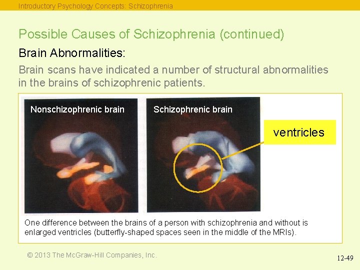 Introductory Psychology Concepts: Schizophrenia Possible Causes of Schizophrenia (continued) Brain Abnormalities: Brain scans have