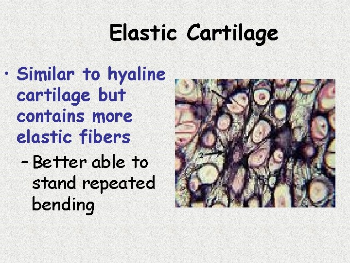 Elastic Cartilage • Similar to hyaline cartilage but contains more elastic fibers – Better