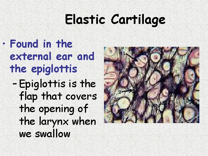 Elastic Cartilage • Found in the external ear and the epiglottis – Epiglottis is