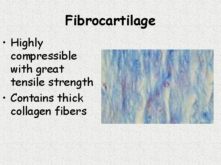 Fibrocartilage • Highly compressible with great tensile strength • Contains thick collagen fibers 