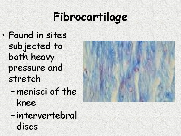 Fibrocartilage • Found in sites subjected to both heavy pressure and stretch – menisci