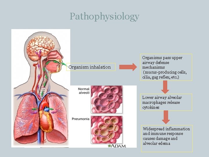 Pathophysiology Organism inhalation Organisms pass upper airway defense mechanisms (mucus-producing cells, cilia, gag reflex,