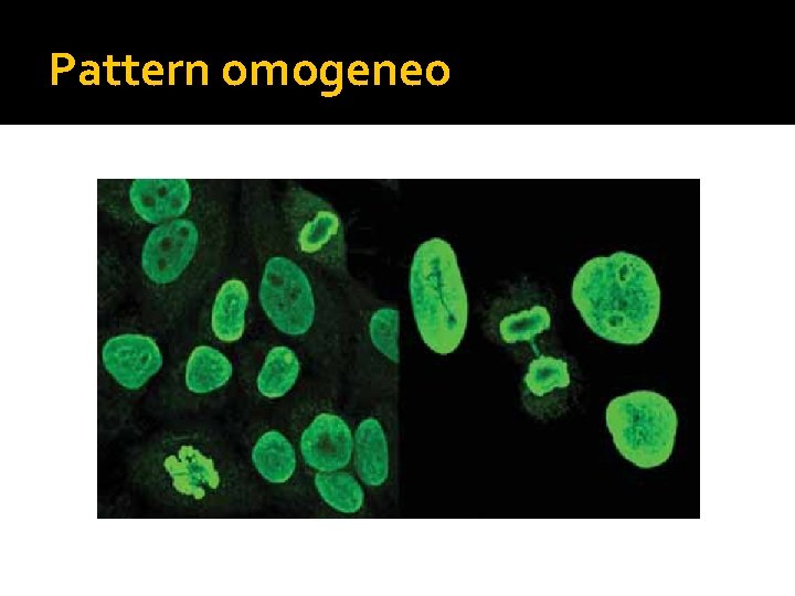 Pattern omogeneo 