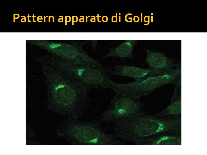 Pattern apparato di Golgi 