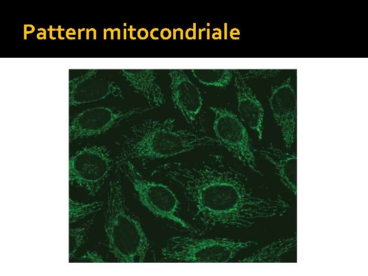 Pattern mitocondriale 