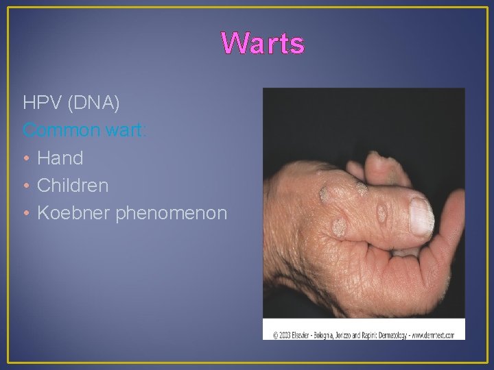 Warts HPV (DNA) Common wart: • Hand • Children • Koebner phenomenon 