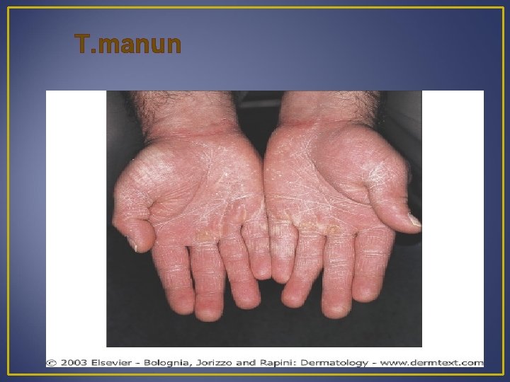 T. manun 