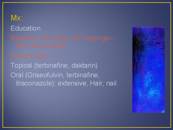 Mx: Education Scraping, hair plug, nail clippings--KOH and culture Wood’s light ---Topical (terbinafine, daktarin)