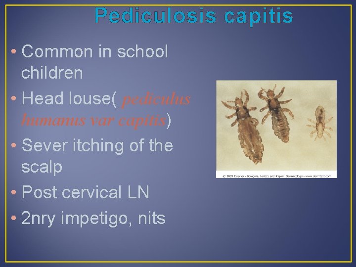 Pediculosis capitis • Common in school children • Head louse( pediculus humanus var capitis)
