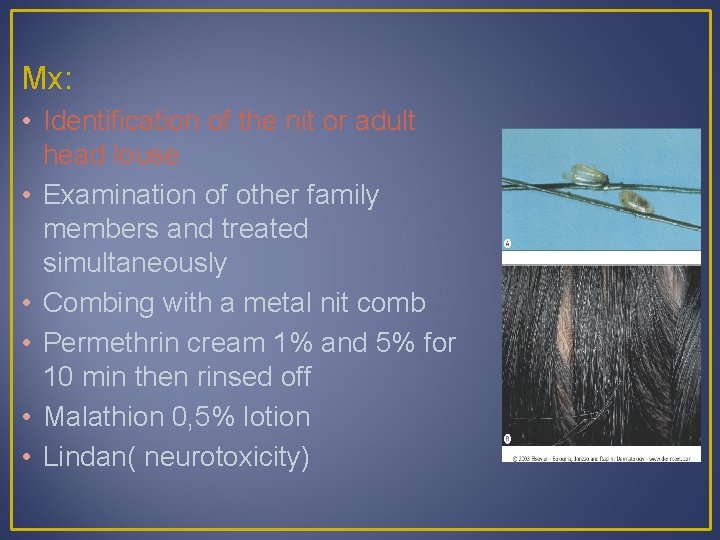Mx: • Identification of the nit or adult head louse • Examination of other