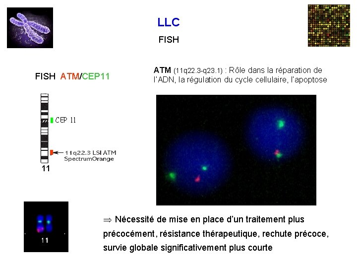 LLC FISH ATM/CEP 11 ATM (11 q 22. 3 -q 23. 1) : Rôle