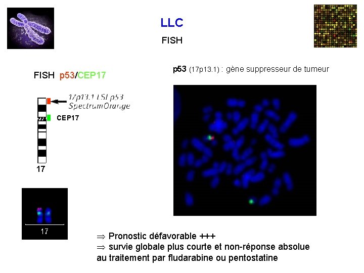LLC FISH p 53/CEP 17 p 53 (17 p 13. 1) : gène suppresseur