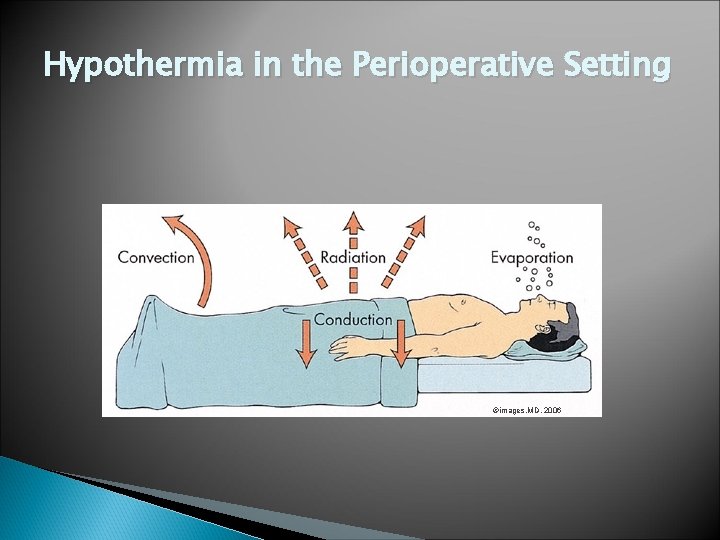 Hypothermia in the Perioperative Setting ©images. MD, 2006 