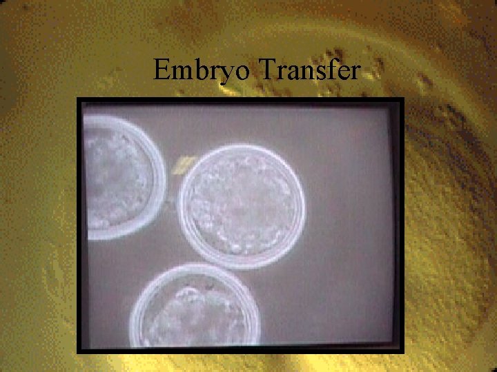 Embryo Transfer 