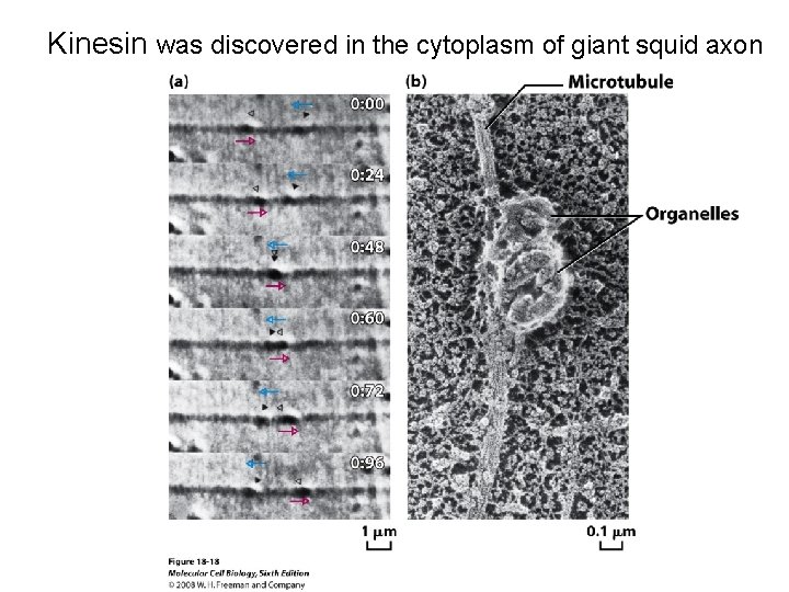 Kinesin was discovered in the cytoplasm of giant squid axon 