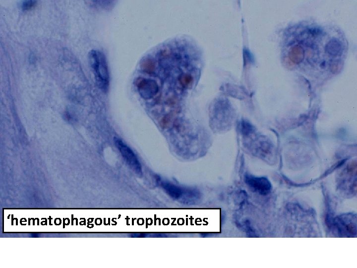 ‘hematophagous’ trophozoites 