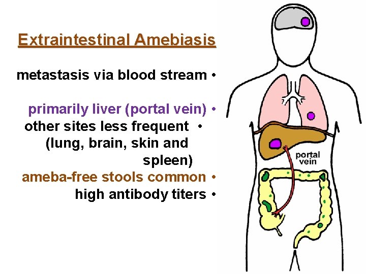 Extraintestinal Amebiasis metastasis via blood stream • primarily liver (portal vein) • other sites