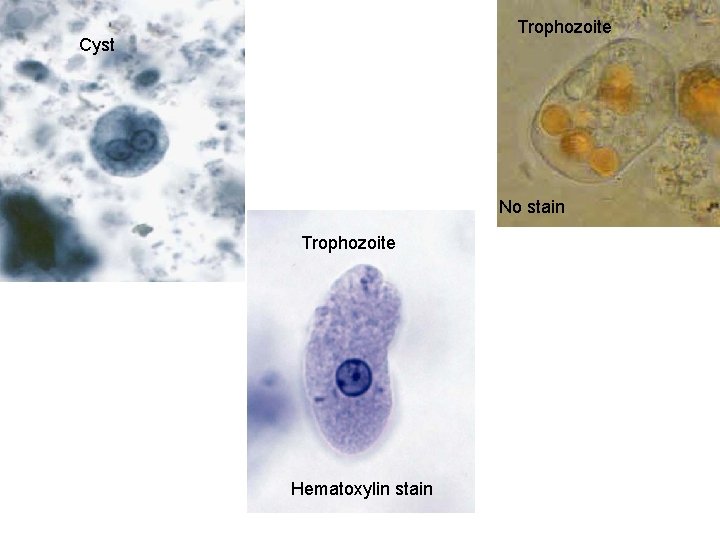 Trophozoite Cyst No stain Trophozoite Hematoxylin stain 