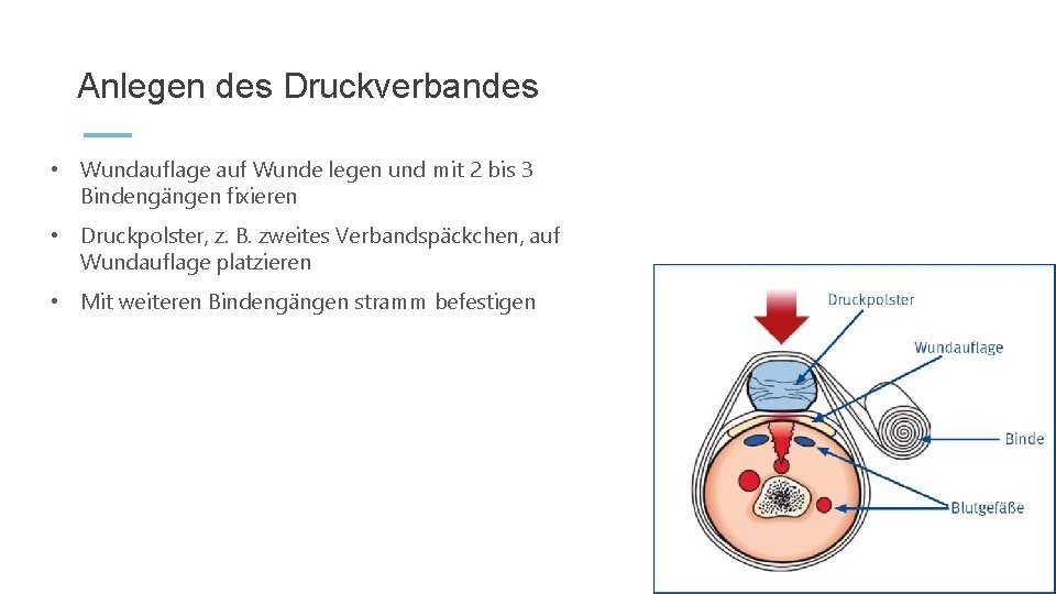 Anlegen des Druckverbandes • Wundauflage auf Wunde legen und mit 2 bis 3 Bindengängen