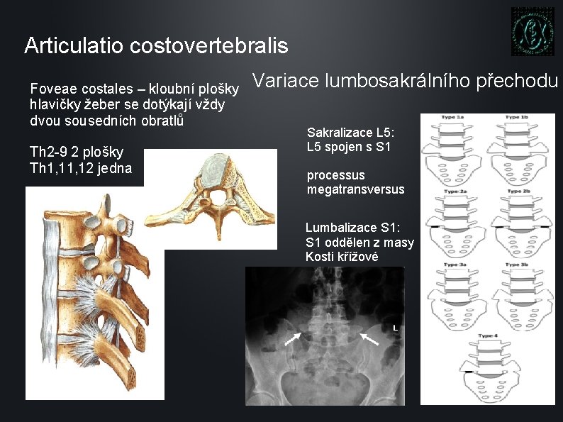 Articulatio costovertebralis Foveae costales – kloubní plošky hlavičky žeber se dotýkají vždy dvou sousedních
