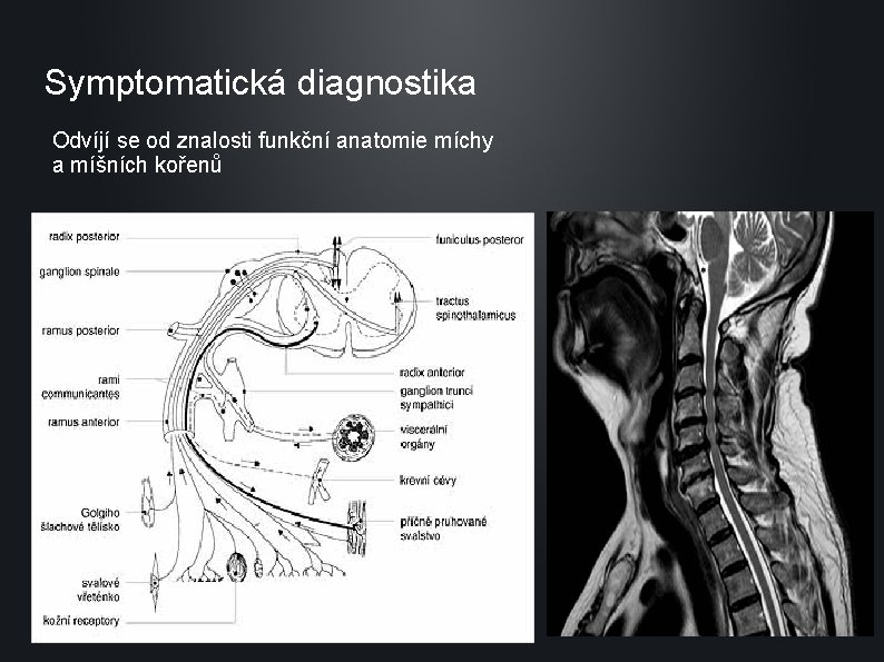 Symptomatická diagnostika Odvíjí se od znalosti funkční anatomie míchy a míšních kořenů 