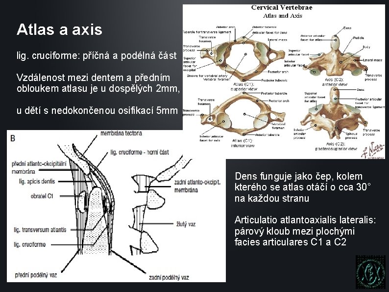 Atlas a axis lig. cruciforme: příčná a podélná část Vzdálenost mezi dentem a předním