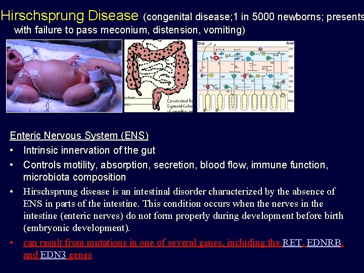 Hirschsprung Disease (congenital disease; 1 in 5000 newborns; presents with failure to pass meconium,