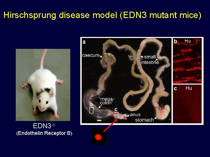 Hirschsprung disease model (EDN 3 mutant mice) EDN 3 -/(Endothelin Receptor B) 