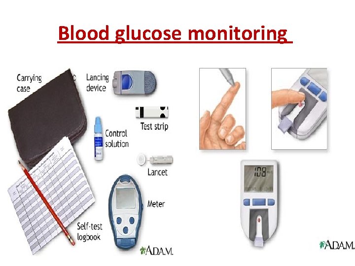 Blood glucose monitoring 