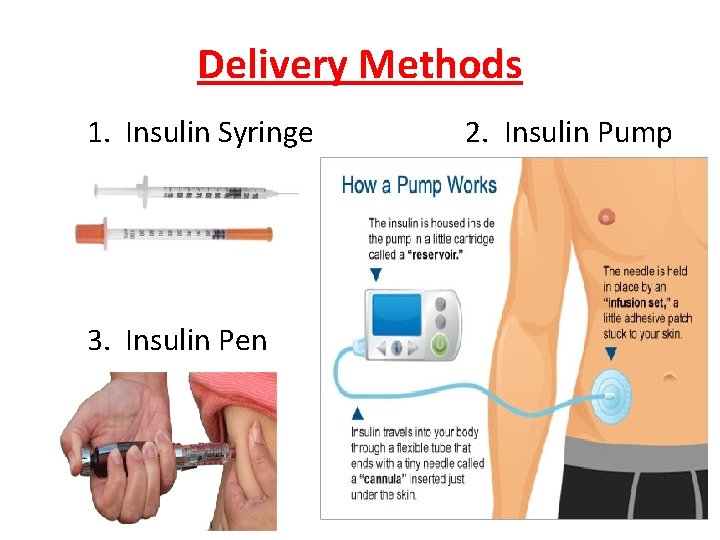 Delivery Methods 1. Insulin Syringe 2. Insulin Pump 3. Insulin Pen 