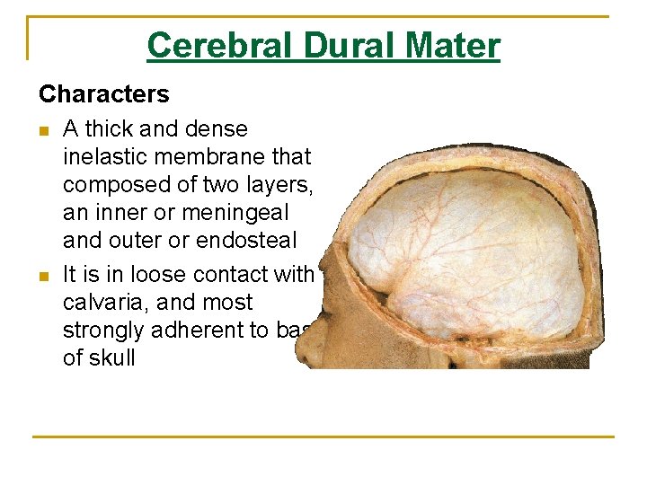 Cerebral Dural Mater Characters n n A thick and dense inelastic membrane that composed Cerebral Dural Mater Characters n n A thick and dense inelastic membrane that composed