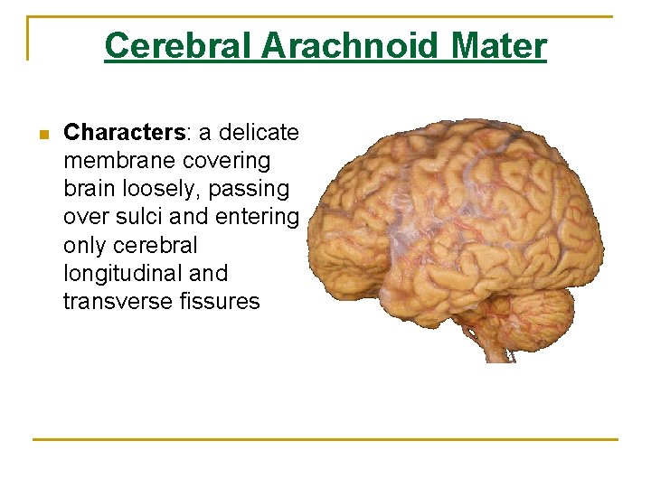 Cerebral Arachnoid Mater n Characters: a delicate membrane covering brain loosely, passing over sulci Cerebral Arachnoid Mater n Characters: a delicate membrane covering brain loosely, passing over sulci