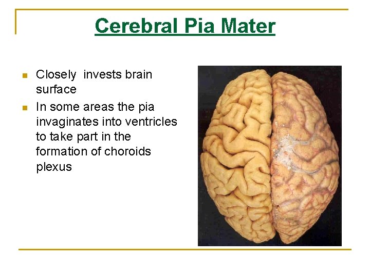 Cerebral Pia Mater n n Closely invests brain surface In some areas the pia Cerebral Pia Mater n n Closely invests brain surface In some areas the pia