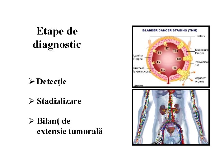 Etape de diagnostic Ø Detecţie Ø Stadializare Ø Bilanţ de extensie tumorală 
