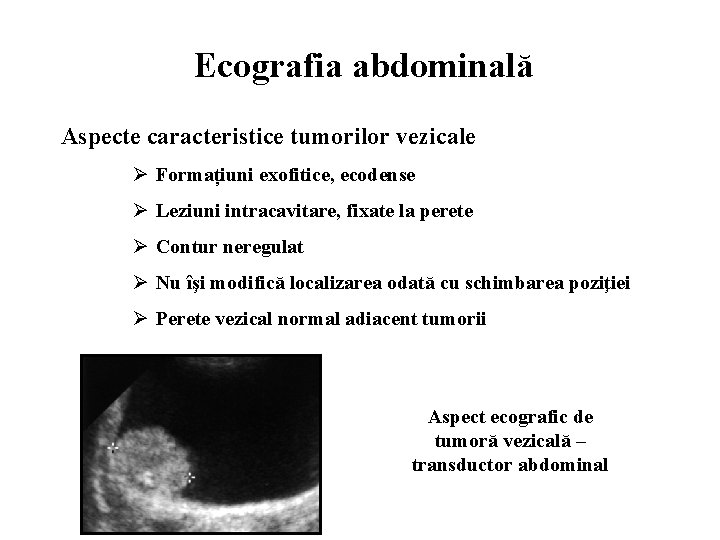 Ecografia abdominală Aspecte caracteristice tumorilor vezicale Ø Formațiuni exofitice, ecodense Ø Leziuni intracavitare, fixate