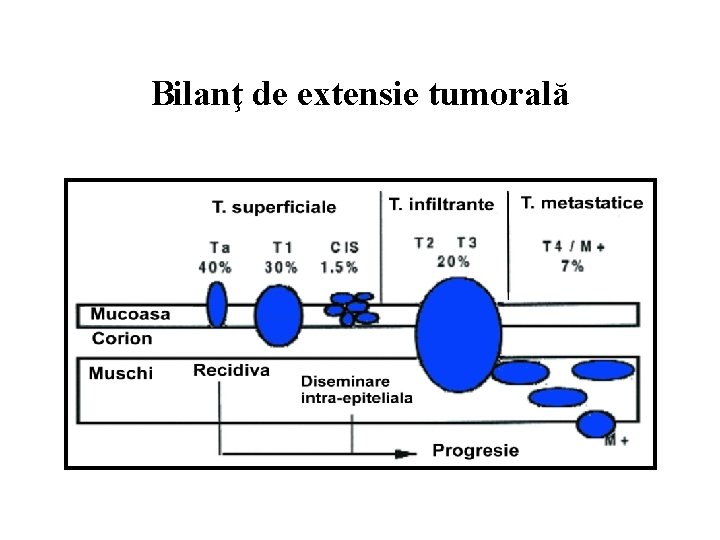 Bilanţ de extensie tumorală 