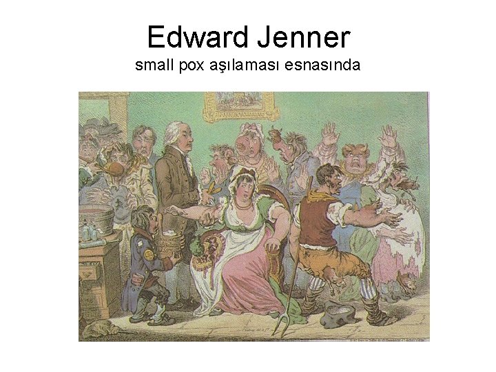 Edward Jenner small pox aşılaması esnasında 