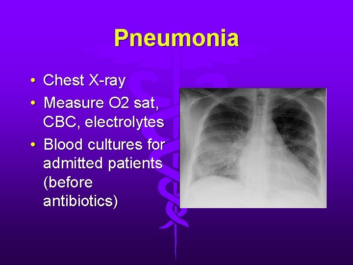 Pneumonia • Chest X-ray • Measure O 2 sat, CBC, electrolytes • Blood cultures Pneumonia • Chest X-ray • Measure O 2 sat, CBC, electrolytes • Blood cultures