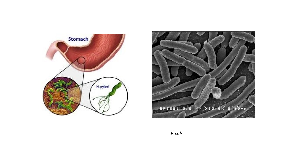 E. coli 