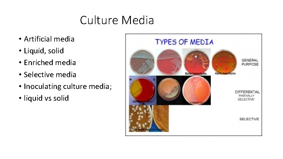 Culture Media • Artificial media • Liquid, solid • Enriched media • Selective media