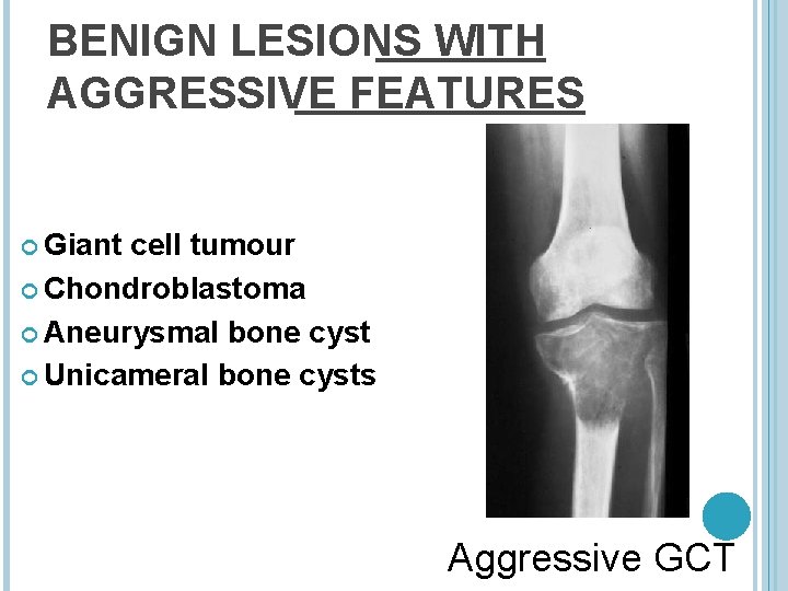 BENIGN LESIONS WITH AGGRESSIVE FEATURES Giant cell tumour Chondroblastoma Aneurysmal bone cyst Unicameral bone