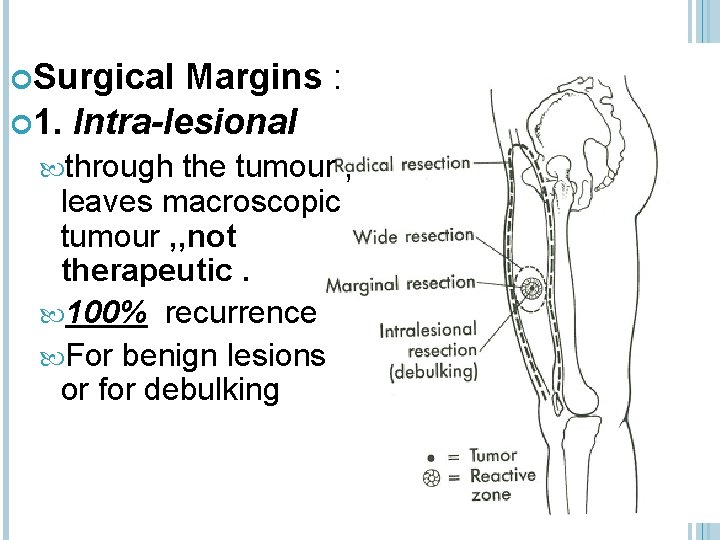  Surgical Margins : 1. Intra-lesional through the tumour , leaves macroscopic tumour ,