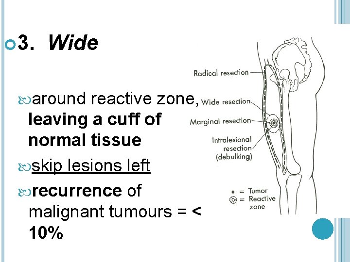  3. Wide around reactive zone, leaving a cuff of normal tissue skip lesions