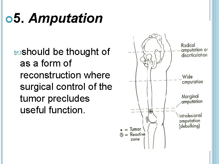  5. Amputation should be thought of as a form of reconstruction where surgical