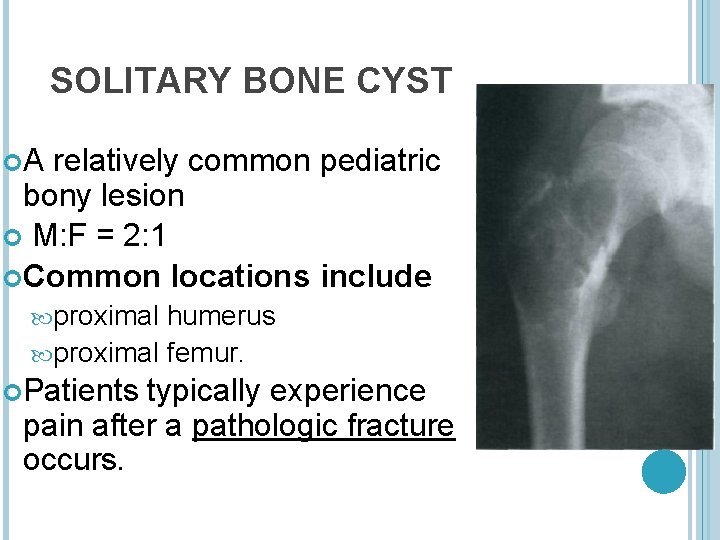 SOLITARY BONE CYST A relatively common pediatric bony lesion M: F = 2: 1