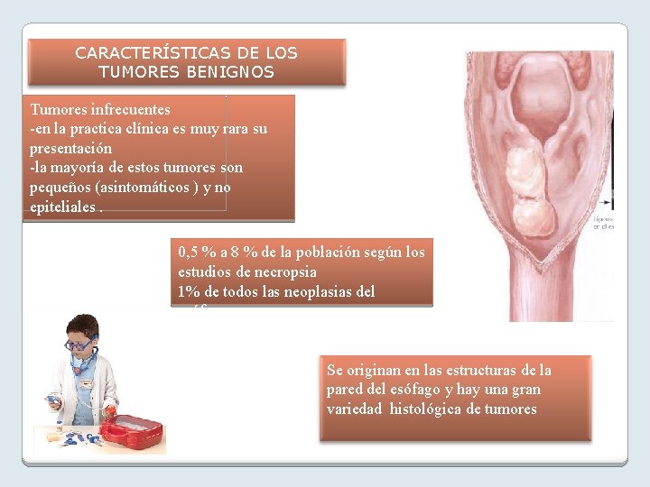 CARACTERÍSTICAS DE LOS TUMORES BENIGNOS Tumores infrecuentes -en la practica clínica es muy rara